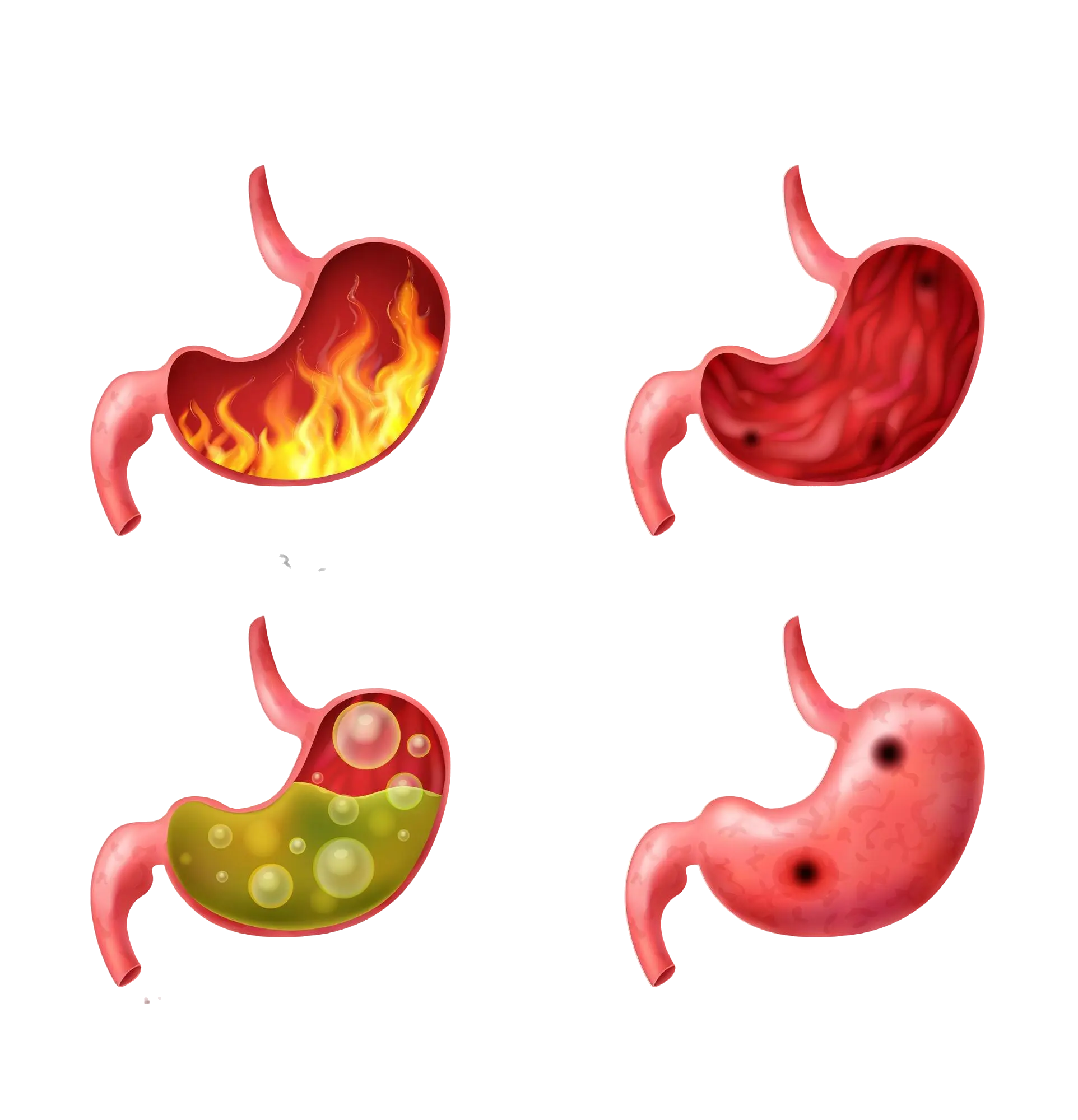 Can acid reflux disease cause asthma flare-ups? | Bangalore Gastro Centre