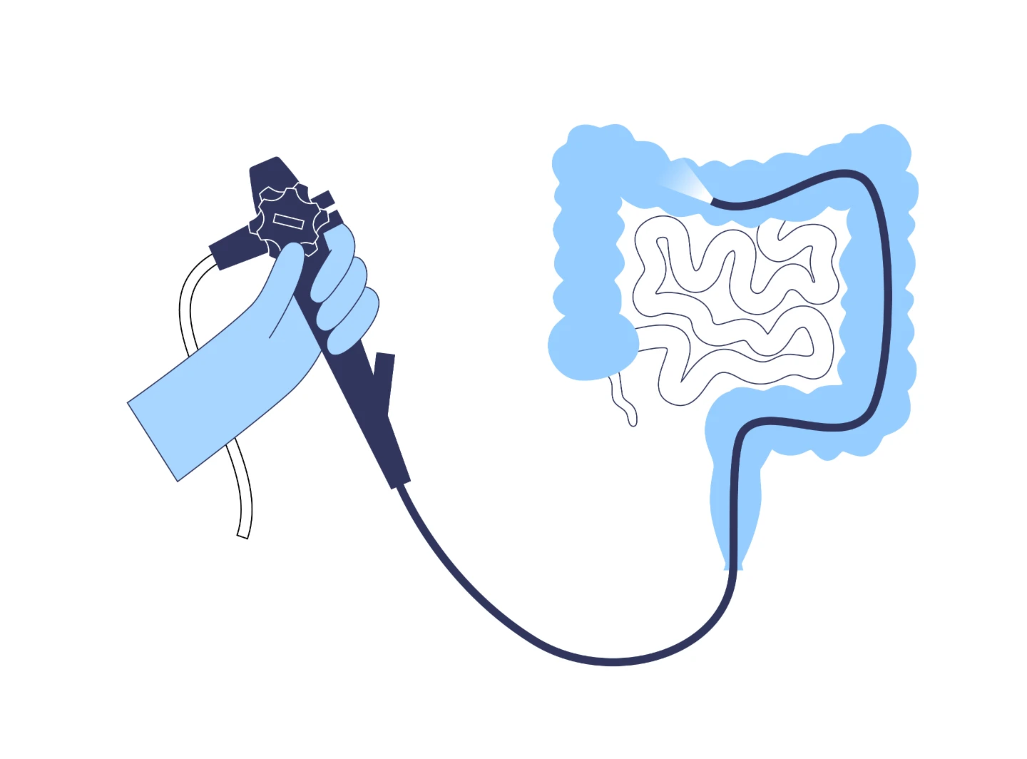 Colonoscopy in Bangalore: Preparation, Procedure & What to Expect